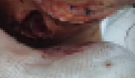 Adolescente de 15 anos é encontrada com ferimento no pescoço e outras lesões dentro de área de mata em Piracicaba – PIRANOT