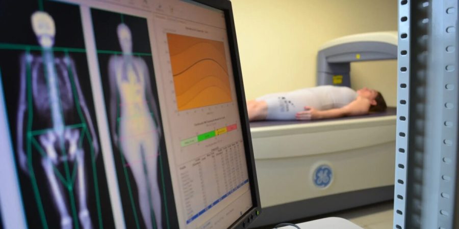 Estudo da UFPel registra excesso de peso em 66,5% aos 30 anos – PIRANOT